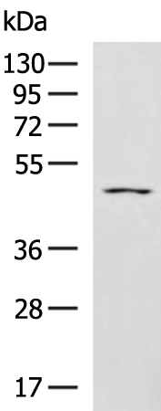 Rabbit Polyclonal Antibody to PTOV1
