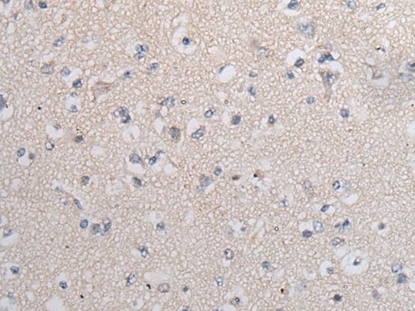 Rabbit Polyclonal Antibody to TGFB1