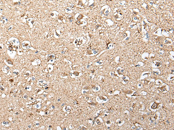 Rabbit Polyclonal Antibody to SLC12A3