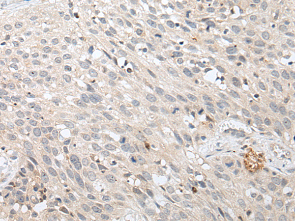 Rabbit Polyclonal Antibody to SULF2