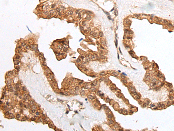 Rabbit Polyclonal Antibody to HOXB9