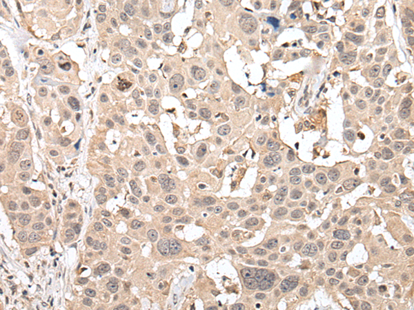 Rabbit Polyclonal Antibody to HOXB7
