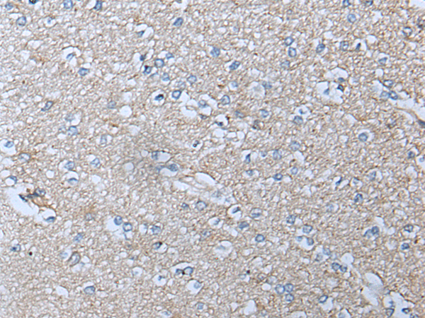 Rabbit Polyclonal Antibody to ACKR3