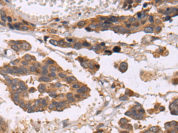 Rabbit Polyclonal Antibody to CXCL10