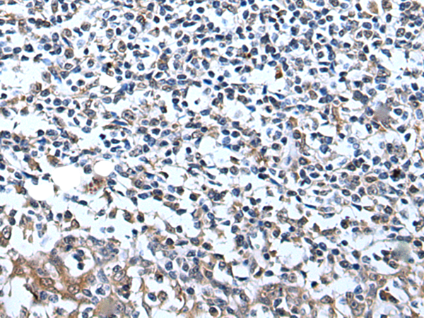Rabbit Polyclonal Antibody to CDC34