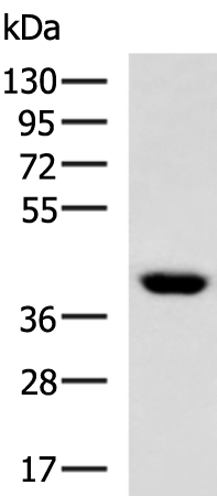 Rabbit Polyclonal Antibody to CNTFR