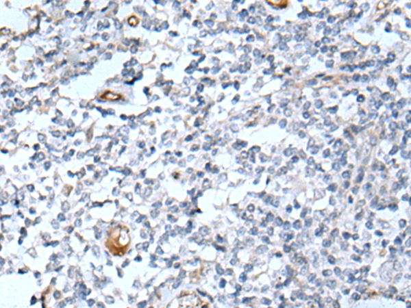 Rabbit Polyclonal Antibody to DLK2