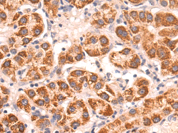 Rabbit Polyclonal Antibody to EMP1