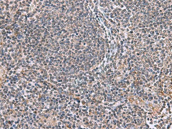 Rabbit Polyclonal Antibody to SFRP2