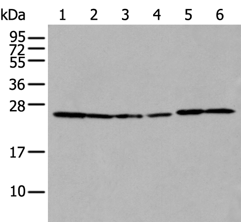 Rabbit Polyclonal Antibody to HSD17B10