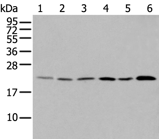 Rabbit Polyclonal Antibody to DUSP3