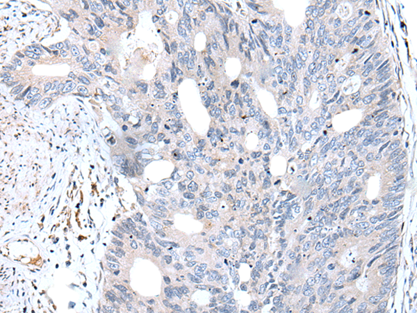 Rabbit Polyclonal Antibody to FABP12