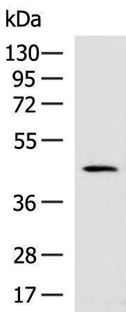 Rabbit Polyclonal Antibody to LGALS9