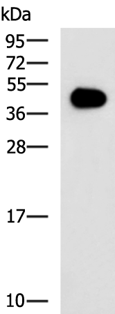 Rabbit Polyclonal Antibody to GAP43