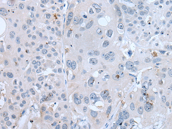 Rabbit Polyclonal Antibody to GAST