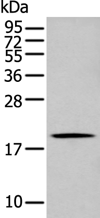 Rabbit Polyclonal Antibody to GKN1