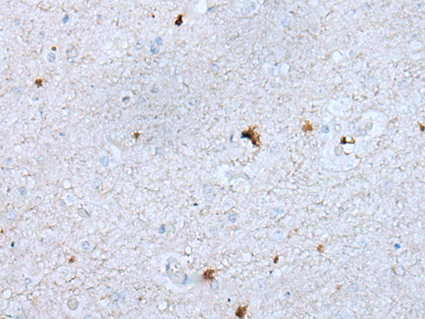 Rabbit Polyclonal Antibody to GAS2L1