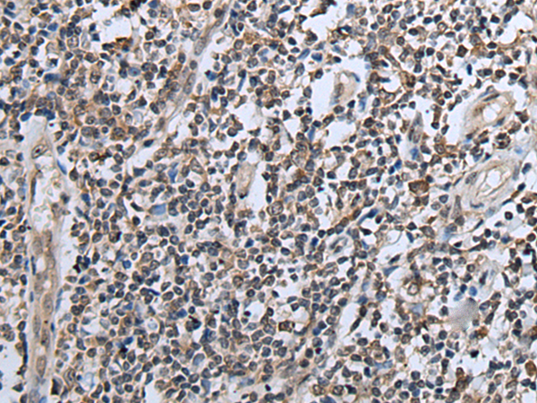 Rabbit Polyclonal Antibody to CXCL6