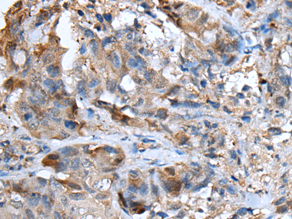 Rabbit Polyclonal Antibody to CXCL5
