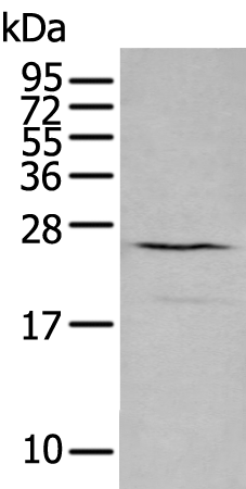 Rabbit Polyclonal Antibody to CXCL16