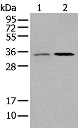 Rabbit Polyclonal Antibody to HOXB5