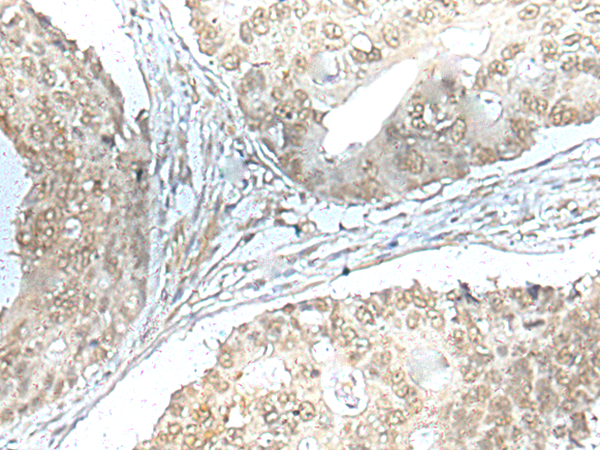 Rabbit Polyclonal Antibody to HOXC11