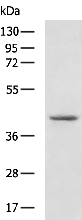 Rabbit Polyclonal Antibody to HOXD10