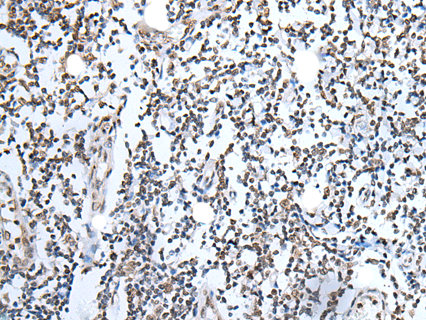 Rabbit Polyclonal Antibody to HOXD12