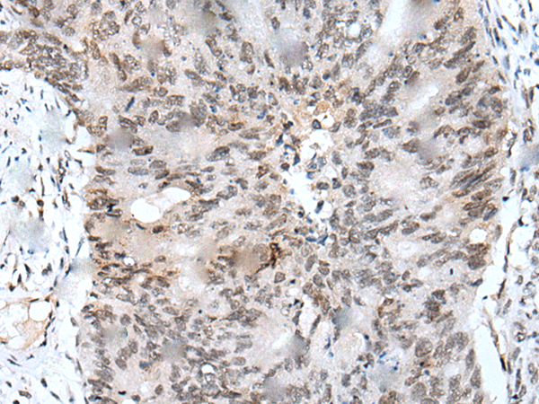 Rabbit Polyclonal Antibody to NRG1