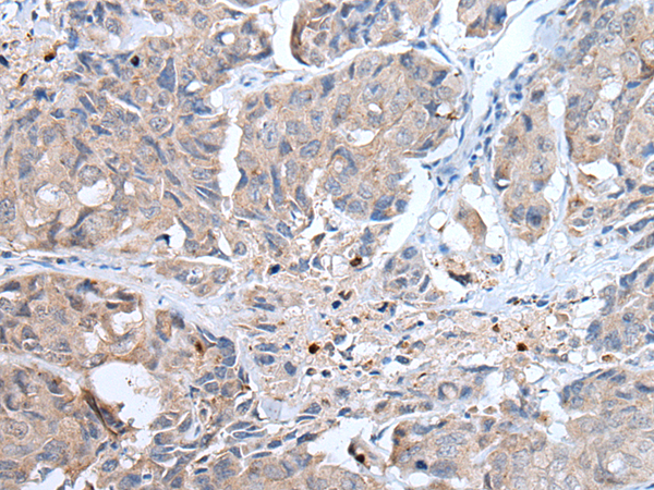 Rabbit Polyclonal Antibody to PLAAT3