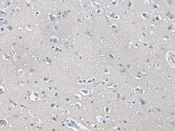 Rabbit Polyclonal Antibody to HSP90AA1