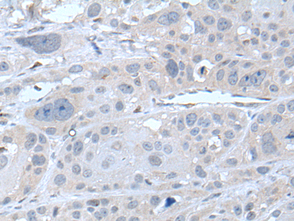 Rabbit Polyclonal Antibody to SDC2