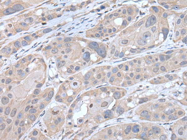 Rabbit Polyclonal Antibody to HTRA2