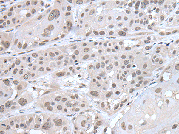 Rabbit Polyclonal Antibody to IFI16