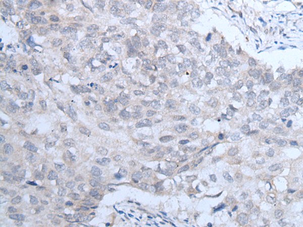 Rabbit Polyclonal Antibody to IGF1R
