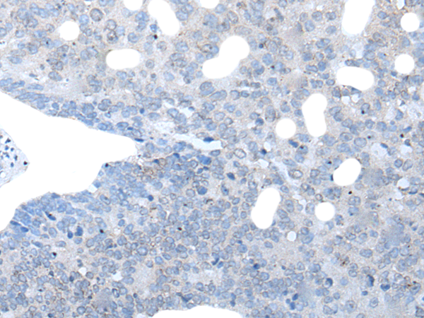 Rabbit Polyclonal Antibody to IGSF11
