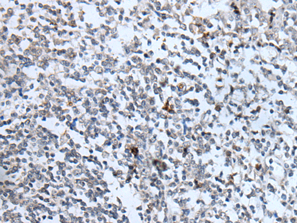 Rabbit Polyclonal Antibody to IL6R