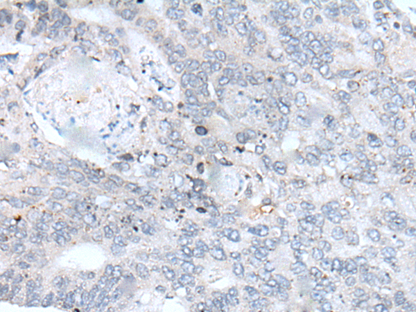 Rabbit Polyclonal Antibody to IL9R