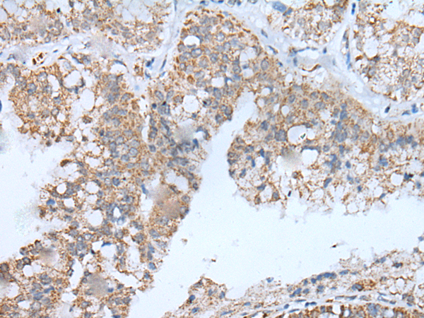 Rabbit Polyclonal Antibody to IGF2BP3