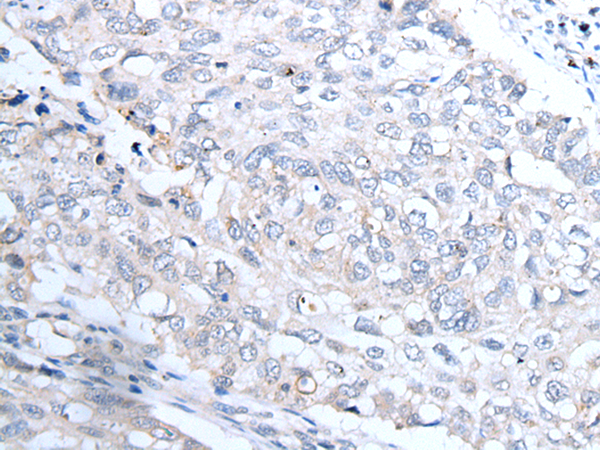Rabbit Polyclonal Antibody to INSR