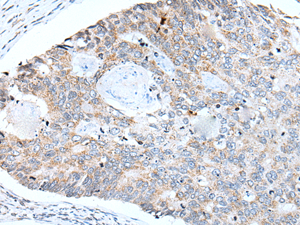 Rabbit Polyclonal Antibody to IRF5