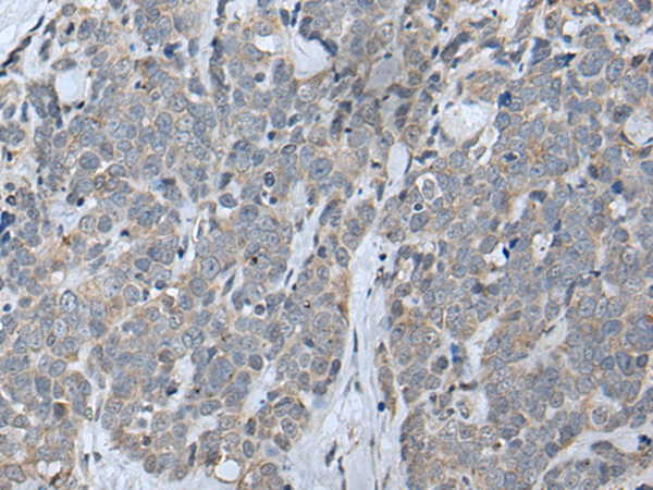 Rabbit Polyclonal Antibody to JAK3