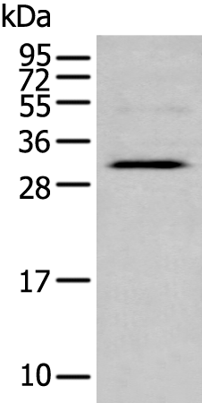 Rabbit Polyclonal Antibody to LAT