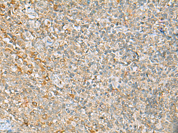 Rabbit Polyclonal Antibody to LRRC49