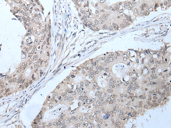 Rabbit Polyclonal Antibody to PPP1R42