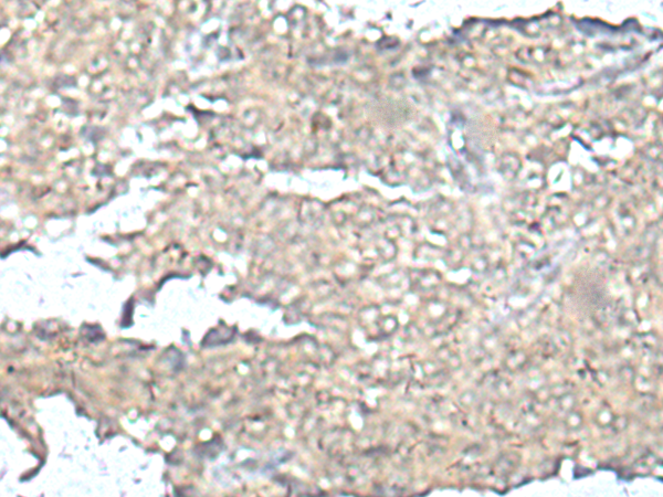 Rabbit Polyclonal Antibody to MEF2D