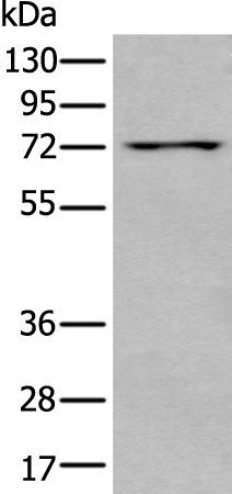 Rabbit Polyclonal Antibody to MEN1