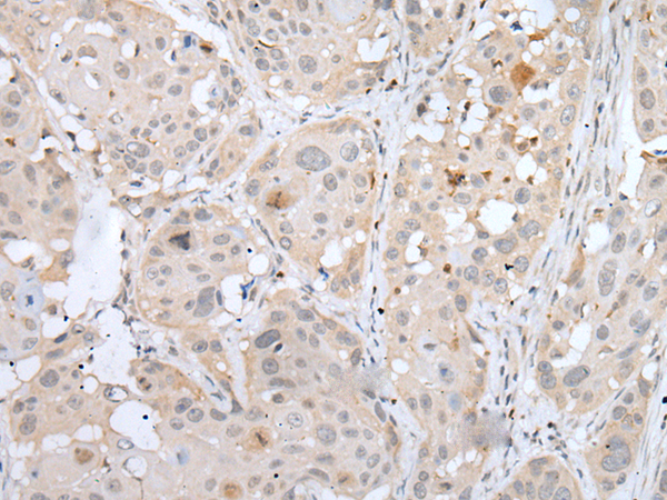 Rabbit Polyclonal Antibody to BORCS8