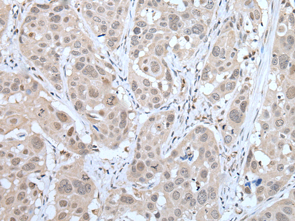 Rabbit Polyclonal Antibody to MTA3