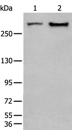 Rabbit Polyclonal Antibody to SPTA1